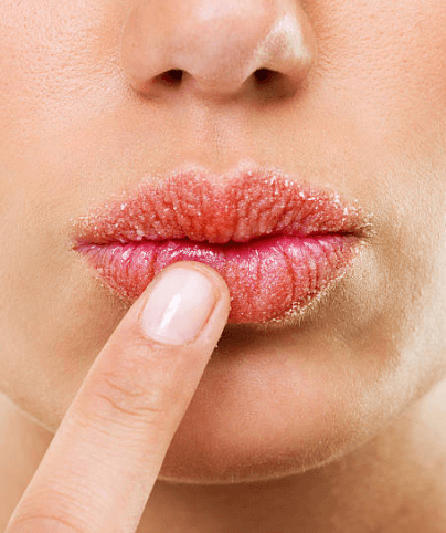 Here’s Why Your Lips Get Dry—and How Our New Lip Balm and Gloss Are the Perfect Remedy