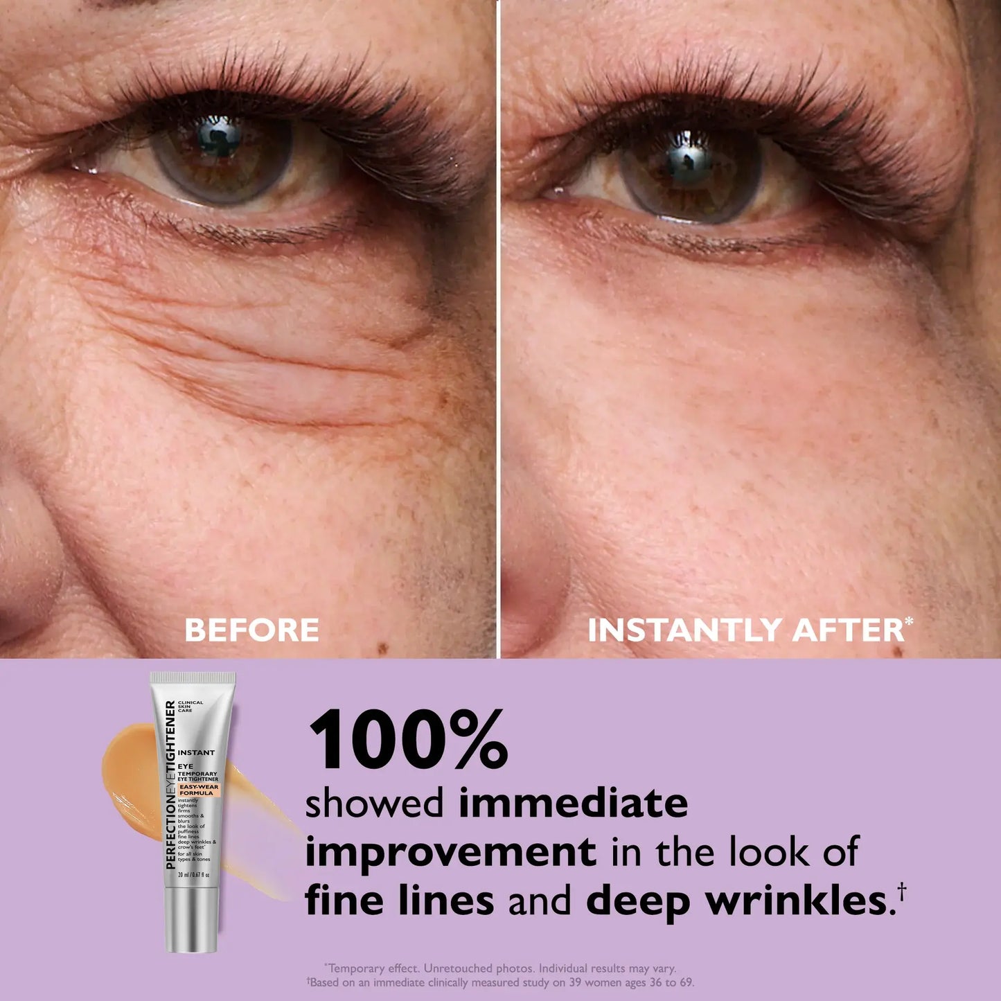 Original Instant Eye Tightener + FREE Brush - 53% OFF